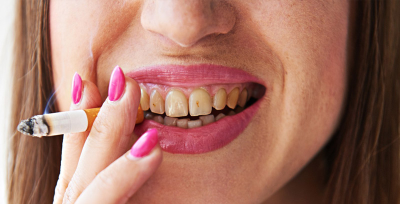 danni causati dal fumo sui denti