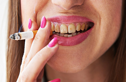Dammi fumo ai denti
