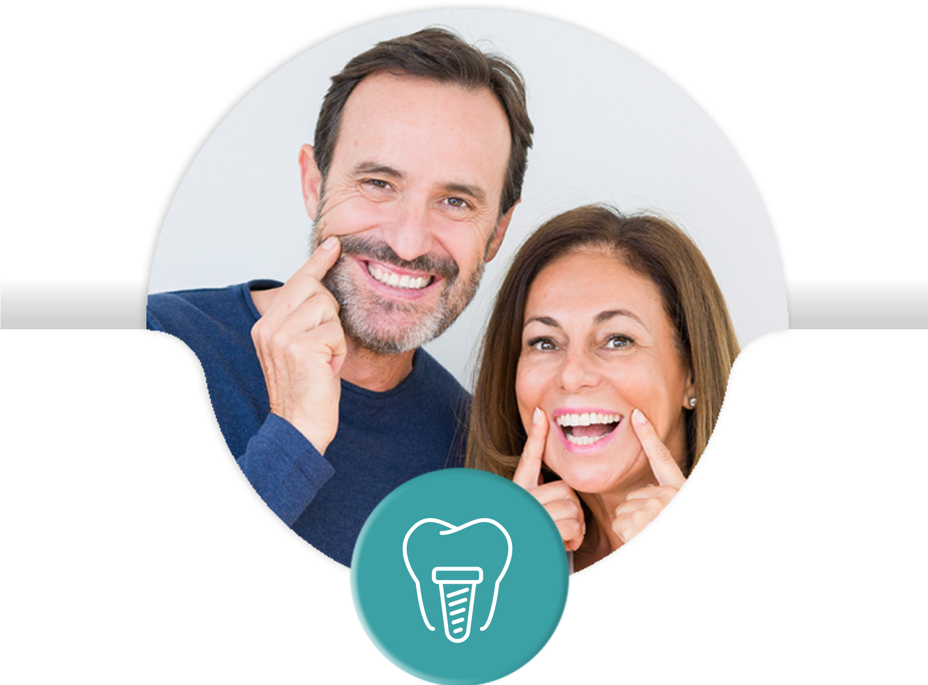 Denti fissi in 24 ore